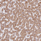 Immunohistochemical staining of human liver shows moderate granular cytoplasmic positivity in hepatocytes.