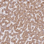 Immunohistochemical staining of human liver shows moderate granular cytoplasmic positivity in hepatocytes.