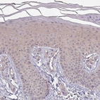 Immunohistochemical staining of human skin shows weak cytoplasmic positivity in squamous epithelial cells.