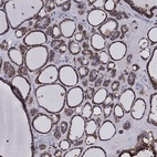 Immunohistochemical staining of human thyroid gland shows high expression.