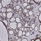 Immunohistochemical staining of human thyroid gland shows high expression.