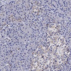 Immunohistochemical staining of human pancreas shows low expression as expected.