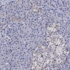 Immunohistochemical staining of human pancreas shows low expression as expected.
