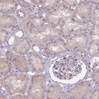 Anti-ZBTB24 Antibody