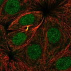 Immunofluorescent staining of human cell line MCF7 shows localization to nucleoplasm & cytokinetic bridge.