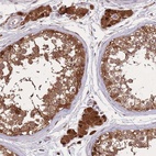 Anti-ZNF639 Antibody