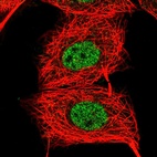 Immunofluorescent staining of human cell line MCF7 shows localization to nucleoplasm.