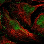 Immunofluorescent staining of human cell line U-2 OS shows localization to nucleoplasm & cell junctions.