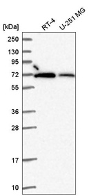 Anti-RBBP5 Antibody