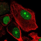 Immunofluorescent staining of human cell line PC-3 shows localization to nucleus & nucleoli.