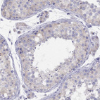 Immunohistochemical staining of human testis shows weak cytoplasmic positivity in cells in seminiferous ducts.