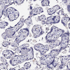 Immunohistochemical staining of human placenta shows no positivity in trophoblastic cells as expected.