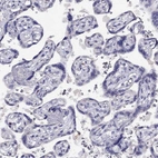 Immunohistochemical staining of human placenta shows no positivity in trophoblastic cells as expected.