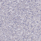 Immunohistochemical staining of human liver shows no positivity in hepatocytes as expected.