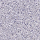 Immunohistochemical staining of human liver shows no positivity in hepatocytes as expected.