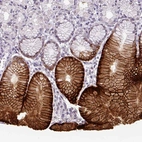 Immunohistochemical staining of human stomach shows strong membranous positivity in glandular cells.