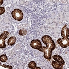 Immunohistochemical staining of human salivary gland shows strong membranous positivity in glandular cells.
