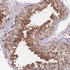 Anti-KLHL29 Antibody