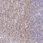 Anti-SAMD1 Antibody