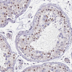 Immunohistochemical staining of human testis shows moderate nuclear positivity in cells in seminiferous ducts.