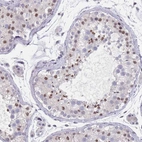 Immunohistochemical staining of human testis shows moderate nuclear positivity in cells in seminiferous ducts.