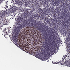 Immunohistochemical staining of human lymph node shows strong cytoplasmic and nuclear positivity in germinal center cells.