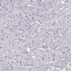 Immunohistochemical staining of human liver shows no positivity in hepatocytes as expected.