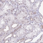 Immunohistochemical staining of human kidney shows weak to moderate positivity in cells in tubules.