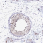 Immunohistochemical staining of human testis shows weak nuclear positivity in cells in seminiferous ducts.