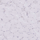 Immunohistochemical staining of human skeletal muscle shows very weak positivity in myocytes.