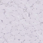 Immunohistochemical staining of human skeletal muscle shows very weak positivity in myocytes.