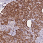 Anti-TRAPPC5 Antibody