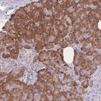 Anti-TRAPPC5 Antibody