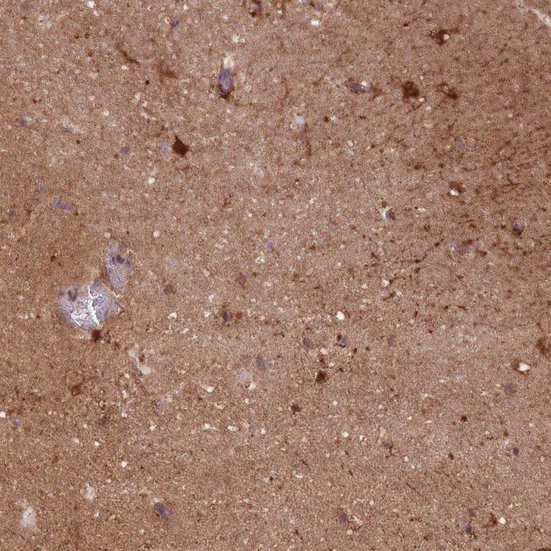 Anti-DPYSL4 Antibody