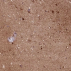 Anti-DPYSL4 Antibody