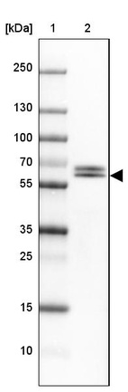 Lane 1: Marker [kDa] 250, 130, 100, 70, 55, 35, 25, 15, 10_br/_Lane 2: Human Cerebral Cortex tissue