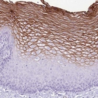 Immunohistochemical staining of human esophagus shows strong membranous positivity in the superficial layer of squamous epithelial cells.