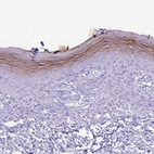 Immunohistochemical staining of human skin shows strong membranous positivity in the superficial layer of squamous epithelial cells.