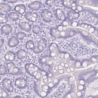 Immunohistochemical staining of human duodenum shows no positivity in glandular cells as expected.