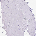 Immunohistochemical staining of human skeletal muscle shows no positivity in myocytes as expected.