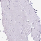 Immunohistochemical staining of human skeletal muscle shows no positivity in myocytes as expected.