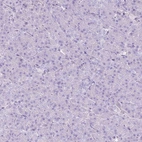 Immunohistochemical staining of human pancreas shows no positivity in exocrine glandular cells as expected.