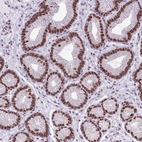 Anti-FAM104B Antibody