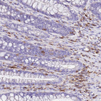 Immunohistochemical staining of human rectum shows strong cytoplasmic positivity in lymphoid cells.
