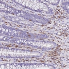 Immunohistochemical staining of human rectum shows strong cytoplasmic positivity in lymphoid cells.