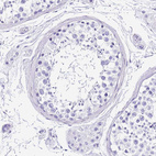 Immunohistochemical staining of human testis shows no positivity in cells in seminiferous ducts as expected.