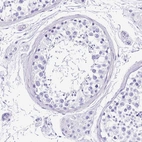 Immunohistochemical staining of human testis shows no positivity in cells in seminiferous ducts as expected.