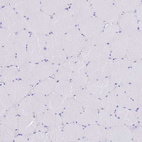 Immunohistochemical staining of human skeletal muscle shows no positivity in myocytes as expected.