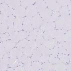 Immunohistochemical staining of human skeletal muscle shows no positivity in myocytes as expected.