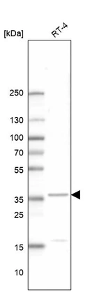Western blot analysis in human cell line RT-4.